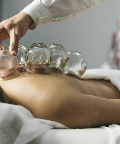 client-with-suction-cup-process